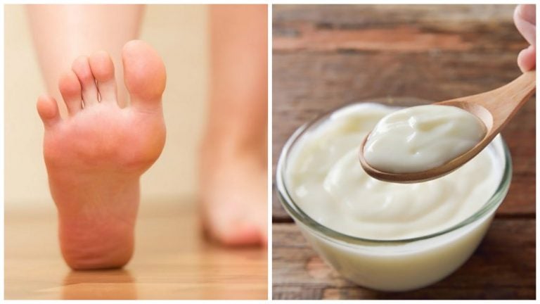 Remueve las durezas de los pies con yogur y vinagre