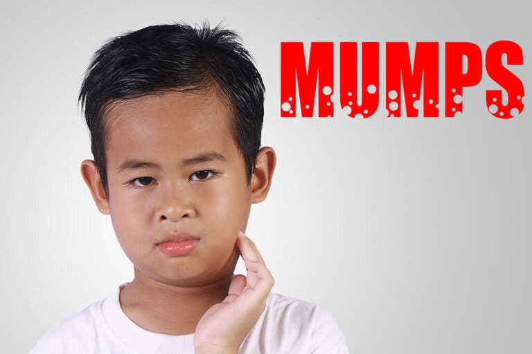 Cómo aliviar los síntomas de las paperas