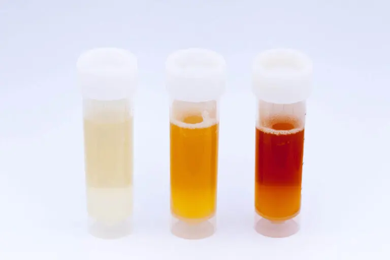 ¿Qué dice el color de la orina sobre la salud?