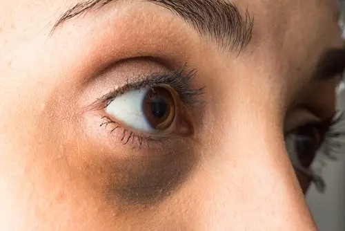 Adiós a las ojeras en 5 minutos