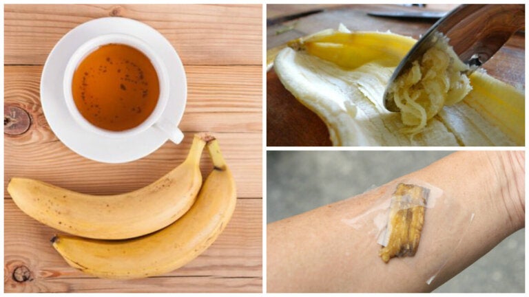 5 formas de utilizar las cáscaras de banana como remedio natural