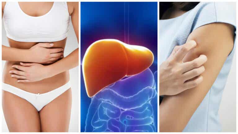 8 síntomas que te aquejan cuando tu hígado está sobrecargado de toxinas