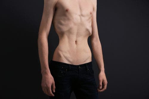 Some figure