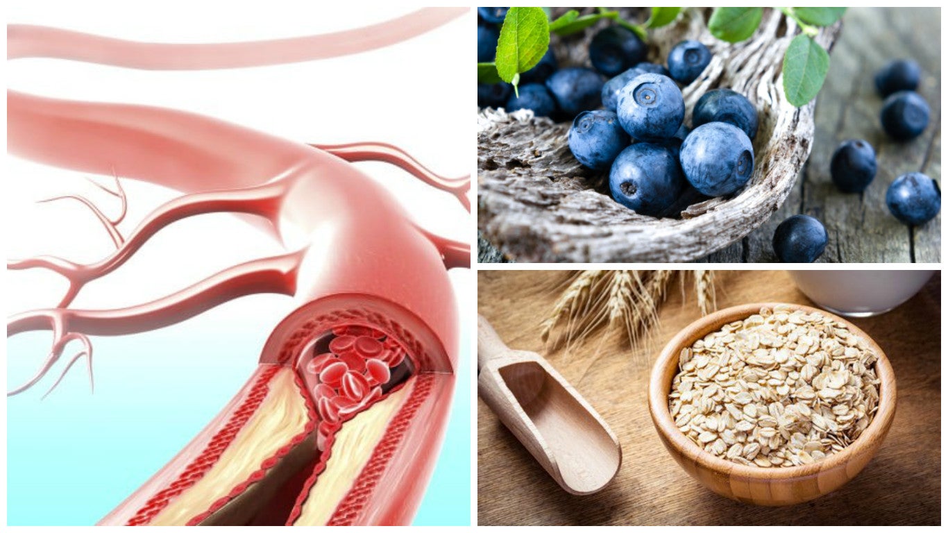 Mejora tu salud arterial consumiendo estos 9 alimentos