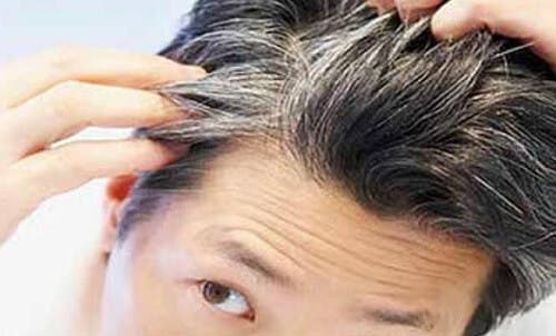 6 vitaminas y alimentos que evitan la aparición temprana de canas
