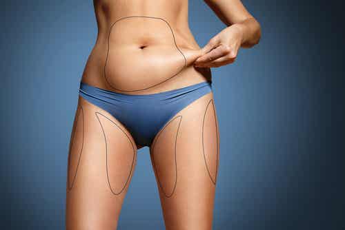 Fakta om kropsfedt illustreres af kvinde med optegninger af fedt på kroppen