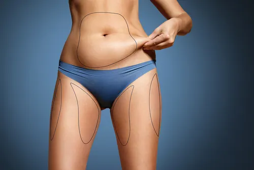 Fakten über Körperfett - Frau kneift sich in den Bauch