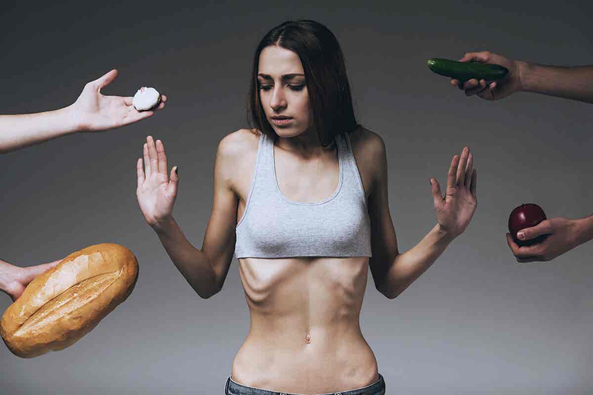 Anorexia en una mujer que usa laxantes para bajar de peso.