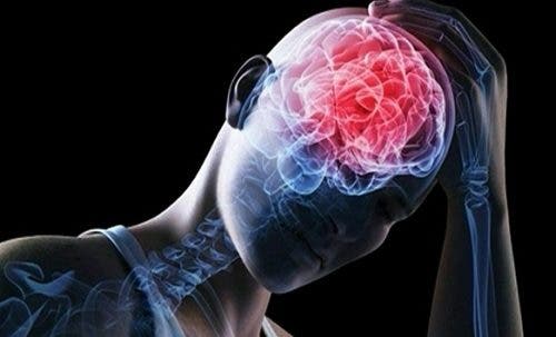 conmocion cerebral