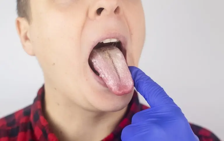 Dieta para la candidiasis: alimentos permitidos y prohibidos