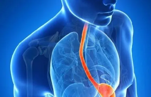 10 síntomas raros del reflujo ácido