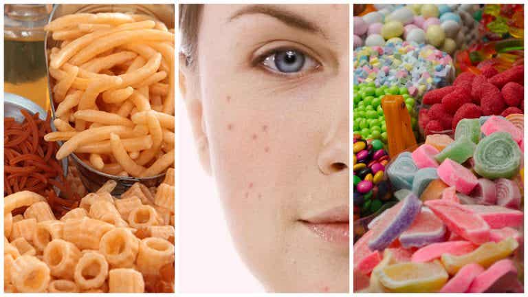 7 alimentos que pueden perjudicar tu piel