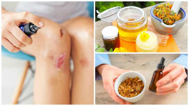 8 ingredientes naturales que puedes usar para aliviar las heridas de la piel