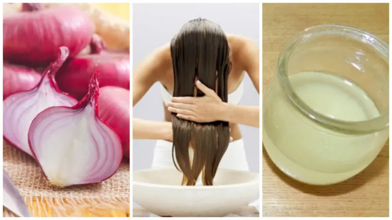 Cómo combatir la caída del cabello con remedios a base de cebolla