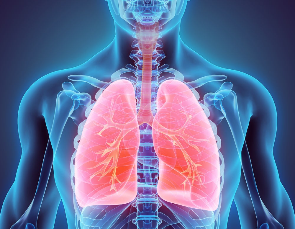 El secuestro broncopulmonar es una alteración estructural que afecta al sistema respiratorio.