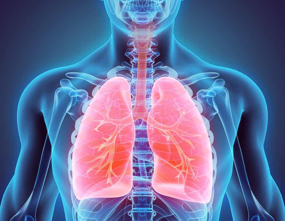 El secuestro broncopulmonar es una alteración estructural que afecta al sistema respiratorio.