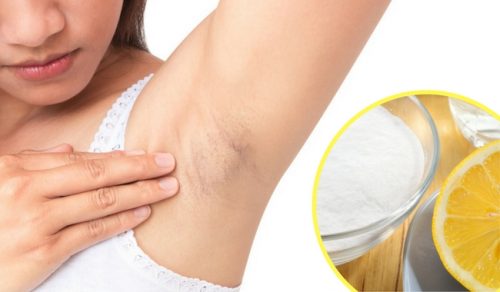 Descubre cómo aclarar tus axilas con estos productos caseros
