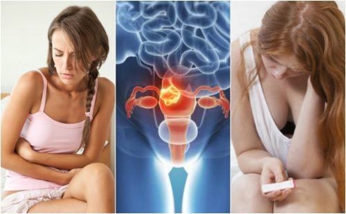 ¿Qué son los miomas uterinos? 5 datos importantes