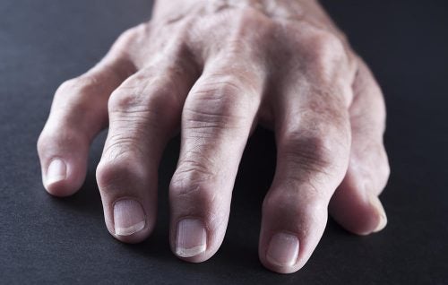 Mi dolor articular se redujo a las 3 semanas tras hacer estos 3 cambios sencillos