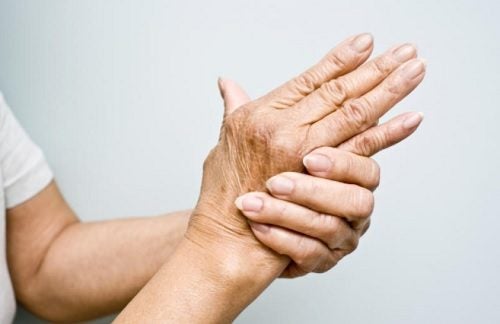 Artritis crónica.