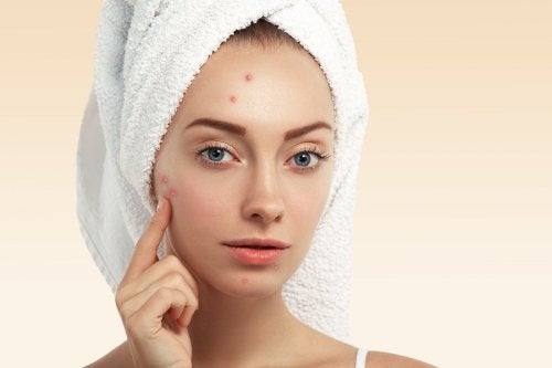 Usos de la vainilla para mejorar la piel y el cabello: evitar aparición de acné