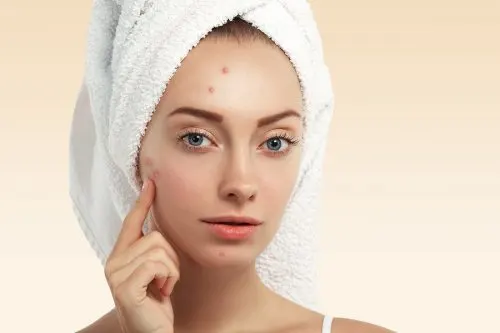 Usos de la vainilla para mejorar la piel y el cabello: evitar aparición de acné