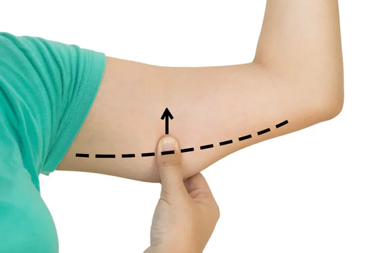6 ejercicios para adelgazar los brazos