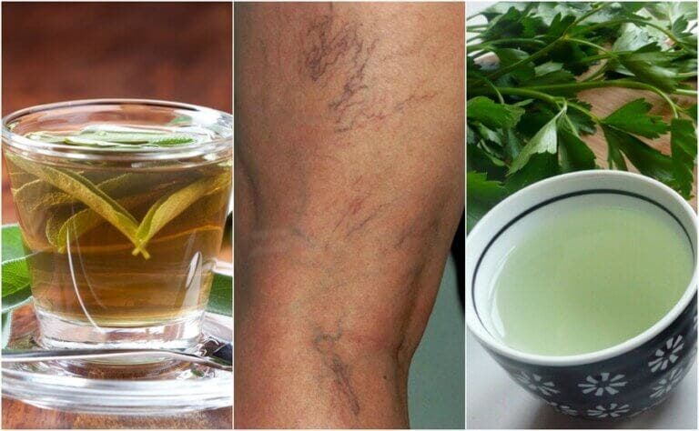5 infusiones diuréticas que te ayudan a combatir las varices