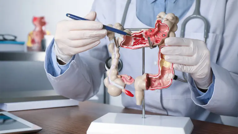 5 remedios naturales para limpiar el colon