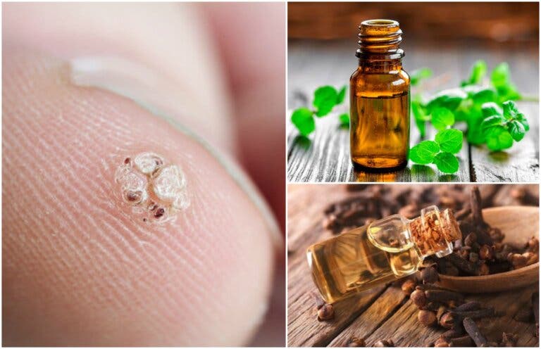 7 aceites esenciales que te ayudarán a combatir las verrugas