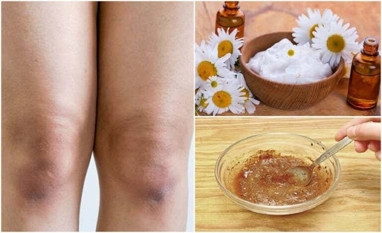 Aclara la piel de tus rodillas con estos 5 exfoliantes naturales