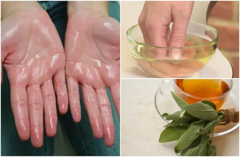 Alivia la hiperhidrosis palmar con estos 7 remedios naturales