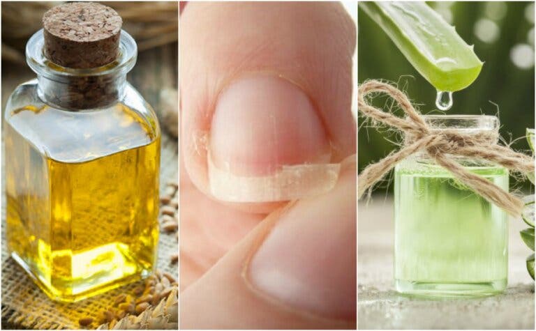 Cómo aliviar las uñas quebradizas con 5 tratamientos de origen natural