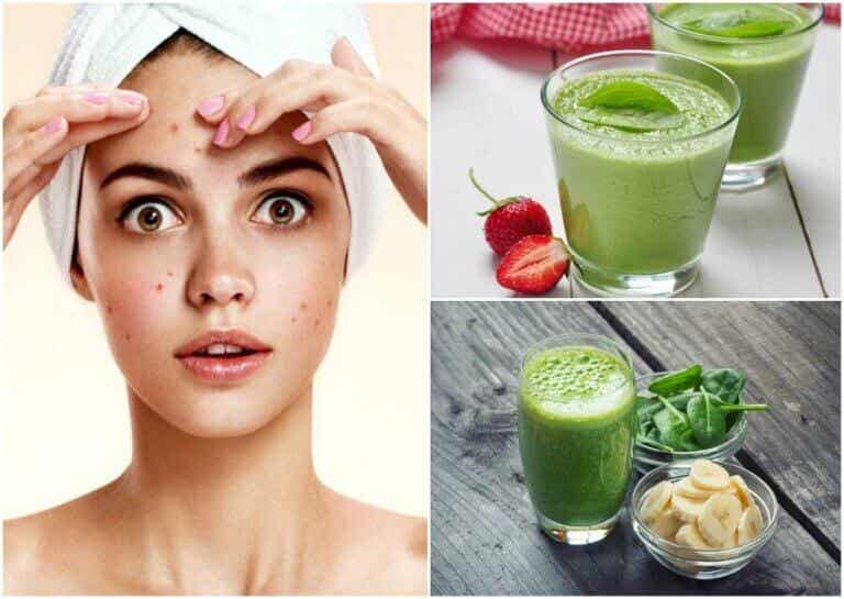 Combate el acné consumiendo estos 5 batidos verdes