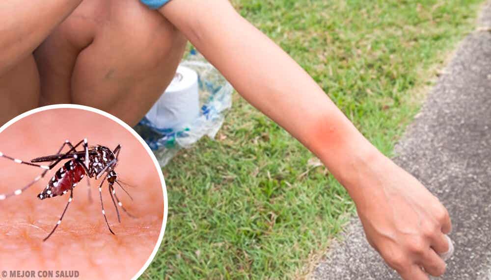 ¿Qué pasa cuando te rascas una picadura de mosquito?