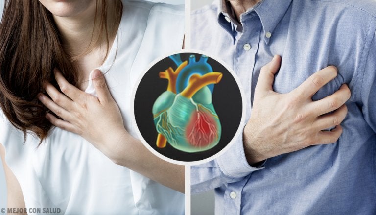¿Son diferentes el infarto femenino y el masculino?