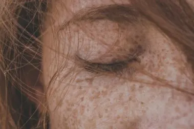 ¿Es posible eliminar las pecas de manera totalmente natural?