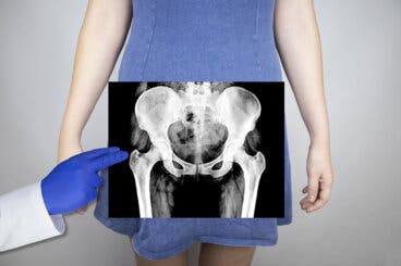 5 problemas presentes en la articulación de la cadera