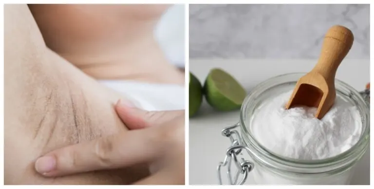 Cómo aclarar las axilas oscuras con 6 remedios naturales
