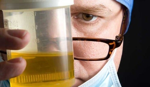 Laborant undersøger forskellige typer urin