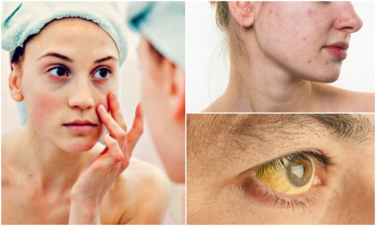 7 señales de deficiencias nutricionales en tu rostro