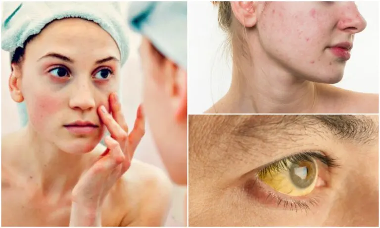 7 señales de deficiencias nutricionales en tu rostro