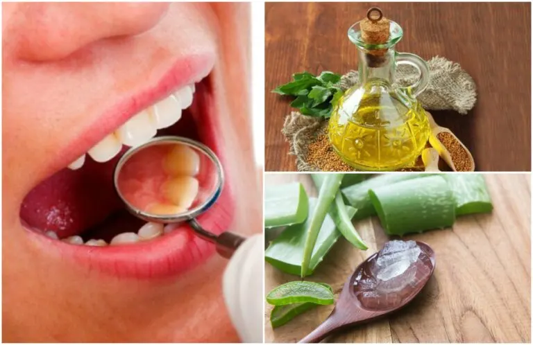 Cómo eliminar el sarro de los dientes con 6 remedios caseros