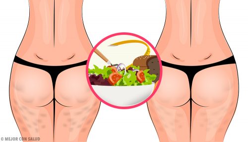 Cómo eliminar la celulitis con una dieta saludable