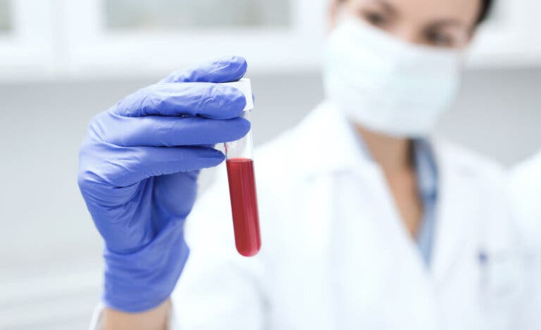 Cómo depurar la sangre con 5 bebidas medicinales