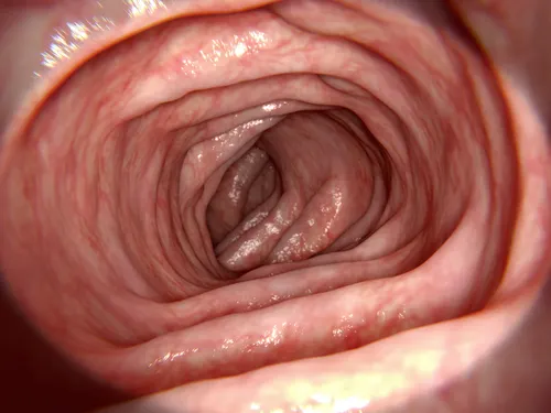 Partes del intestino grueso