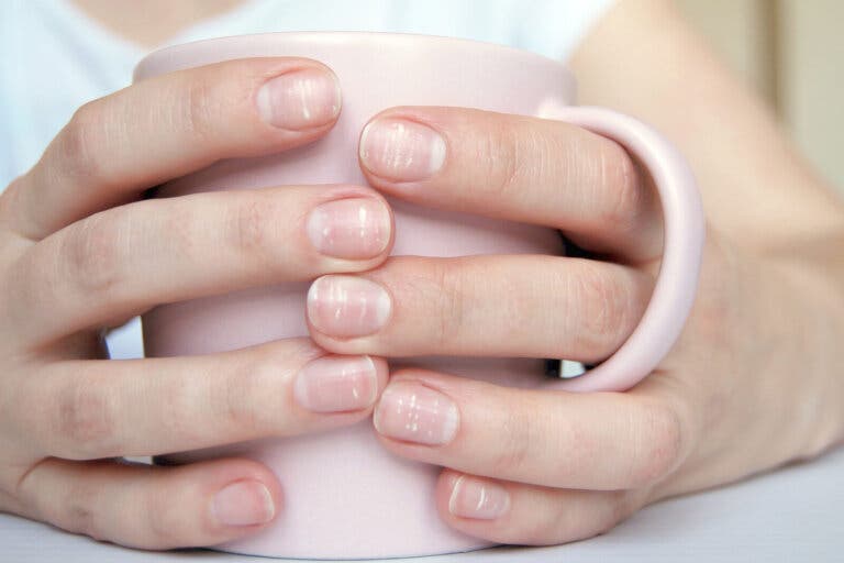 Problemas de salud de los que te advierten las lúnulas de tus uñas