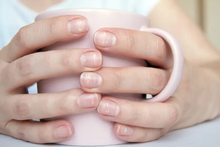 Problemas de salud de los que te advierten las lúnulas de tus uñas