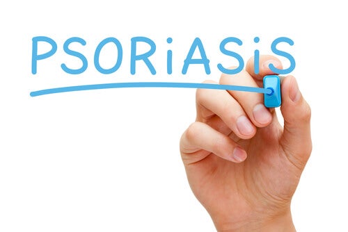 ¿Cuáles son los alimentos indicados para la psoriasis?