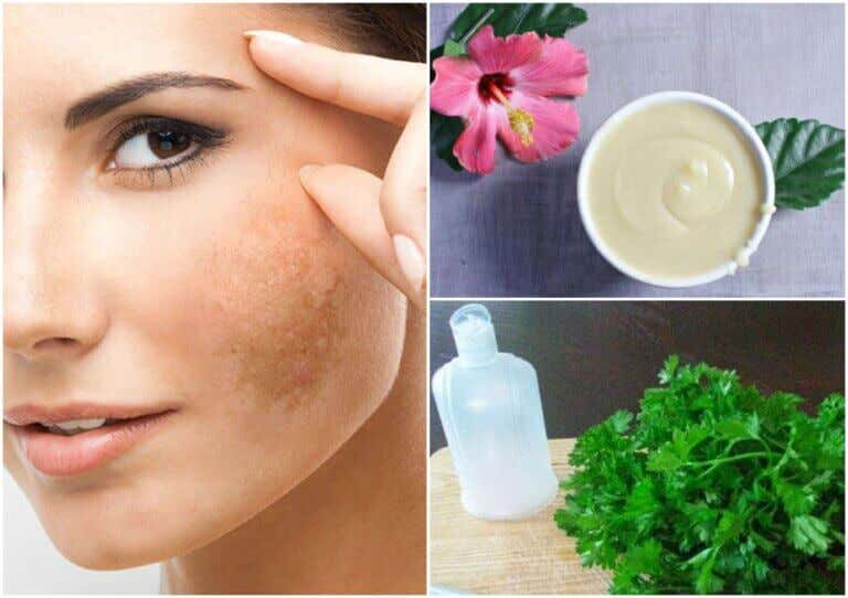 Reduce el paño de tu rostro con 5 tratamientos naturales